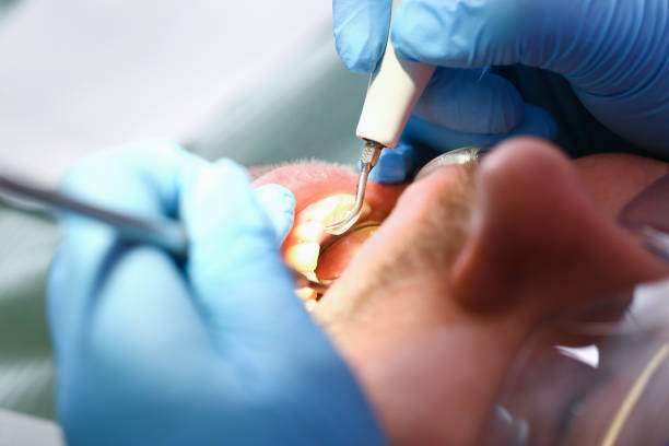 Best Urgent Care for Lost Fillings or Crowns in Pleasant View, UT